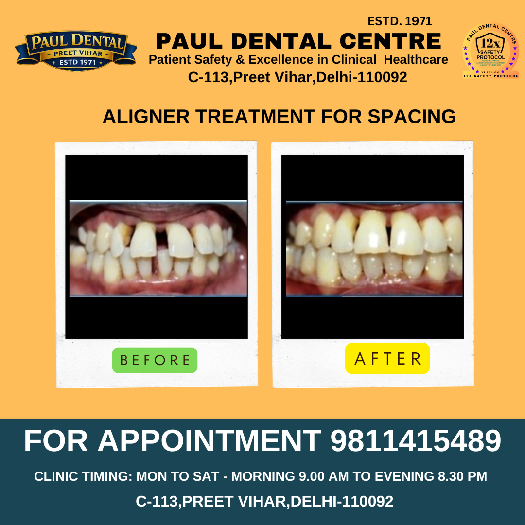 Case 24 – Paul Dental Center
